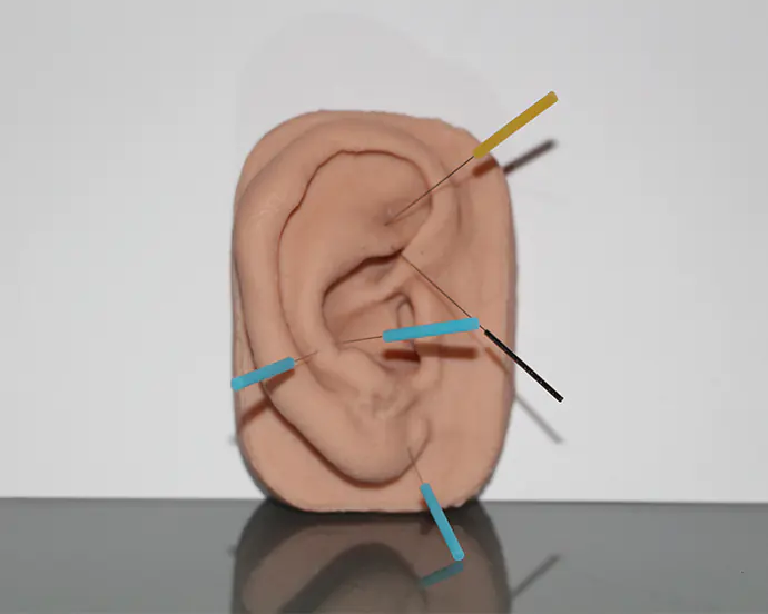 Modellohr mit Akupunkturnadeln in verschiedenen Positionen