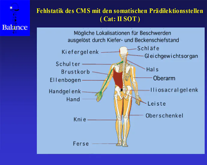 schematische Darstellung des CMS